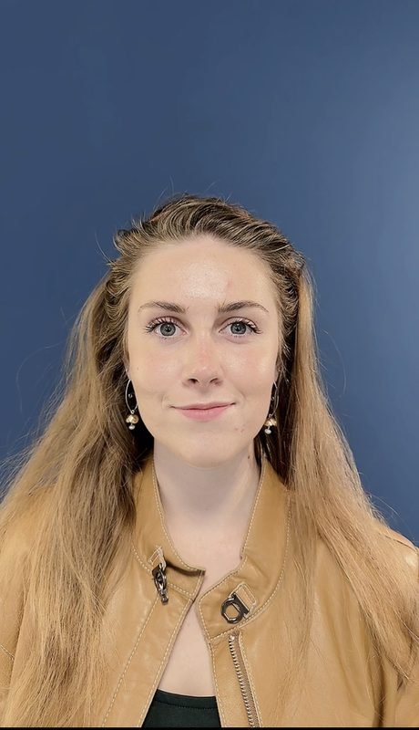 Ksenia V. — Testimonio septorrinoplastia Dr. Jorge Duque